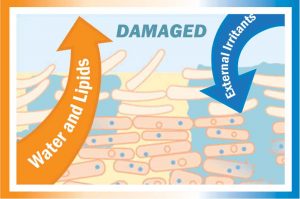 oštećena kožna barijera