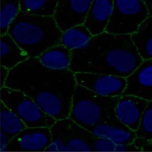 restore poškodba celic zaradi glifosfatov
